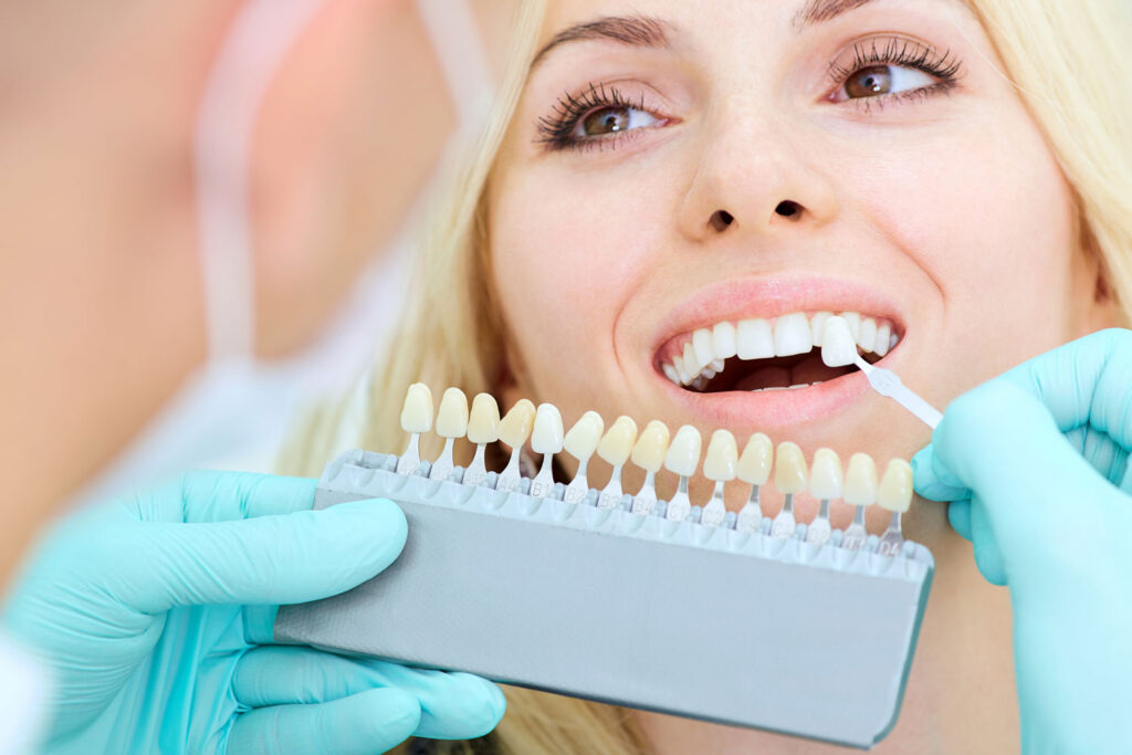 Veneer dentist Orangeville