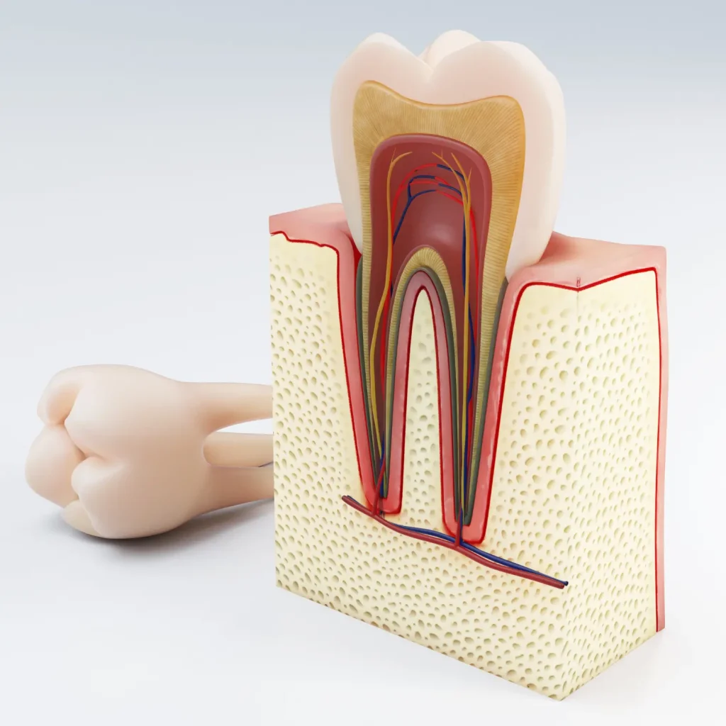 bone graft for implant